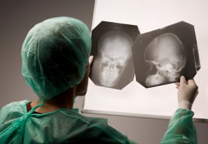 brain and spinal cord injury lawyers - doctor examining xray
