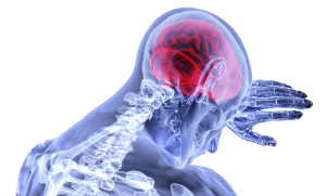 Brain & Head Injury Attorney & Lawyer in Los Angeles, Ca